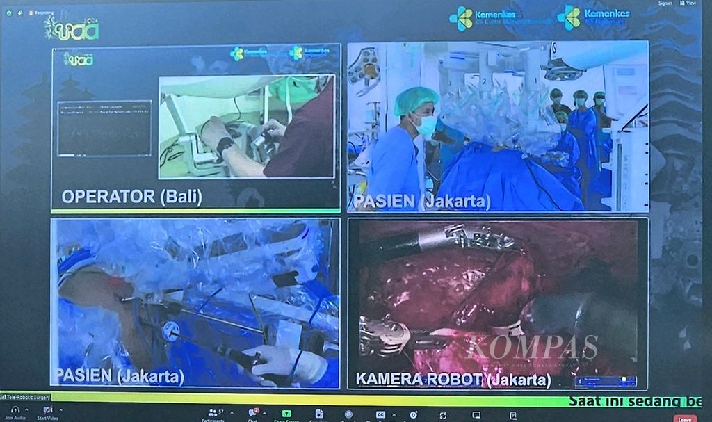 Layar menunjukkan siaran langsung proses operasi telerobotik pertama kali di Indonesia yang dioperatori oleh Ponco Birowo, dokter spesialis urologi RS Prof Ngurah di Bali, terhadap pasien pengidap kista di ginjalnya di RSCM, Jumat (30/8/2024).