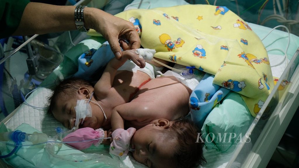 Bayi kembar siam berusia dua bulan, Khalisa dan Khanisa, menjalani perawatan di ruang NICU Gedung Bedah Pusat Terpadu Rumah Sakit Umum Daerah Dr Soetomo, Surabaya, Jawa Timur, Selasa (22/5/2018). 