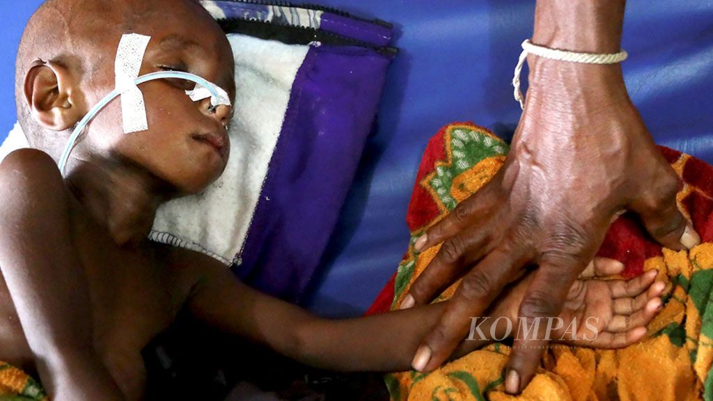 Seorang anak dirawat di RSUD Agats, Papua, karena menderita campak, Jumat (12/1). Sepanjang Januari ini RSUD Agats melayani 34 pasien rawat jalan dan 29 pasien rawat inap penderita campak. Kemarin, tiga dari 15 pasien campak di RS tersebut diperbolehkan pulang ke rumah.