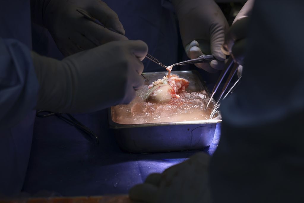 Ginjal babi yang dipersiapkan dicangkokkan ke tubuh pria manula di rumah sakit Massachusetts, Amerika Serikat, Sabtu (16/3/2024).