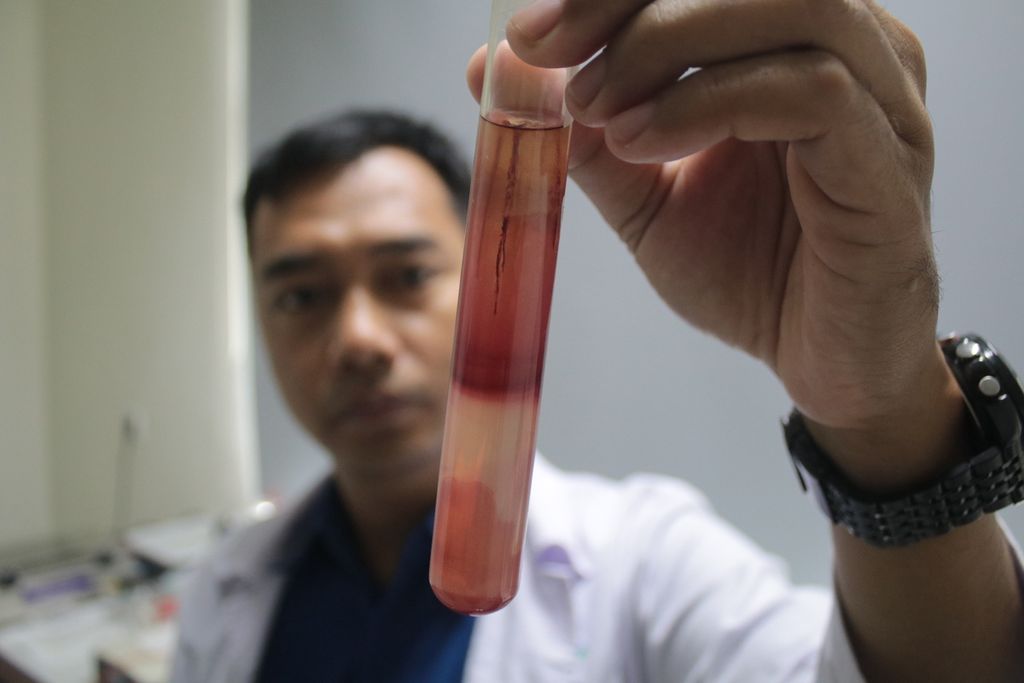 Peneliti dari Ma Chung Research Centre for Photosynthetic Pigments (MRCPP) Universitas Ma Chung, Edi Setiyono, menunjukkan antibiotik alami temuannya pada Senin (3/2/2020) di Laboratorium Mikrobiologi, Universitas Ma Chung. Penggunaan antibiotik pada masyarakat harus lebih bijak untuk mencegah terjadinya resisten antimikroba.