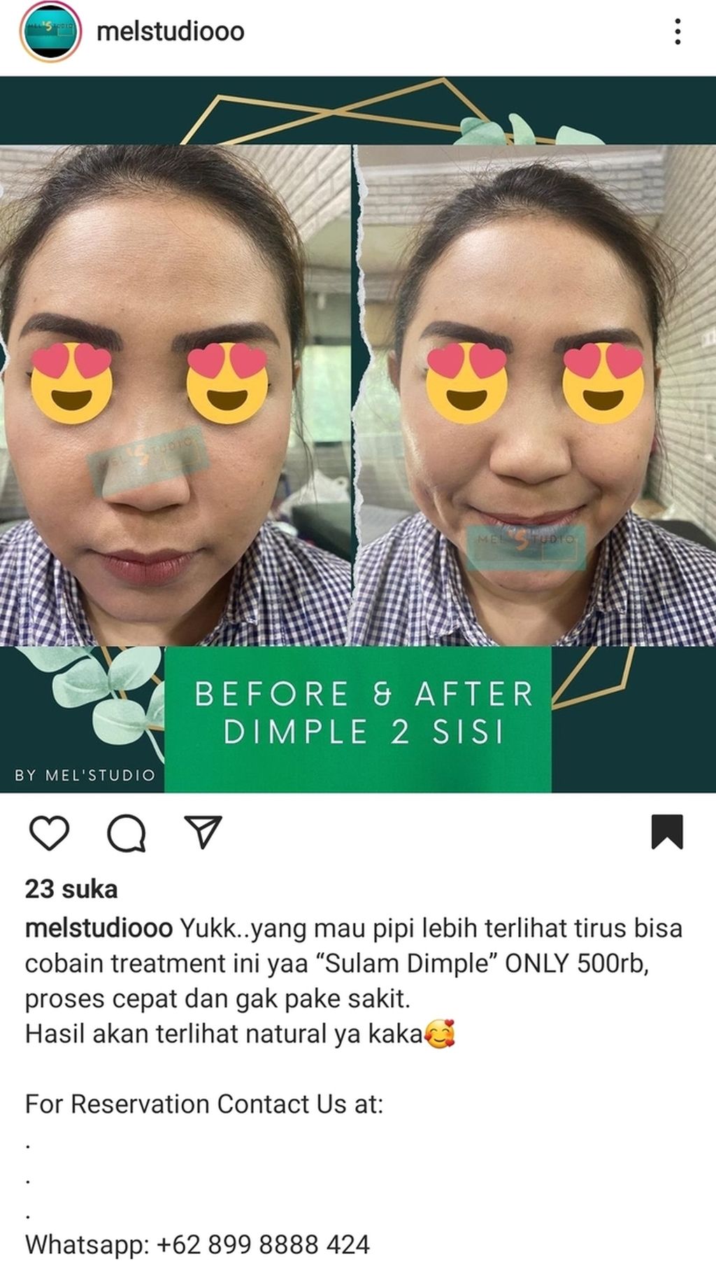 Screenshot on Monday (4/4/2022) of the upload of the dimple embroidery promotion on the Instagram account @melstudiooo. The account belongs to the beauty studio Melstudio, which is located on Jalan Raya Jatiwaringin, Pondok Gede, Bekasi City, West Java.