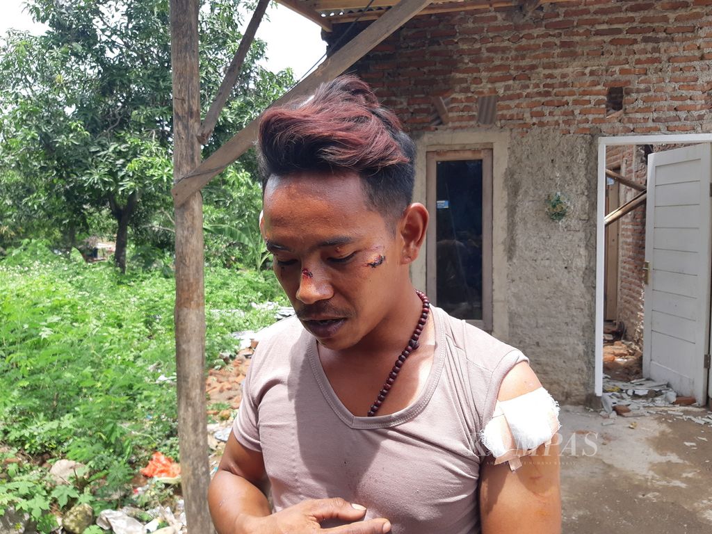 Suwanda (35) menunjukkan luka akibat tertimpa bagian rumah yang ambruk di Blok Surapandan, Kecamatan Harjamukti, Kota Cirebon, Jawa Barat, Rabu (26/10/2022).