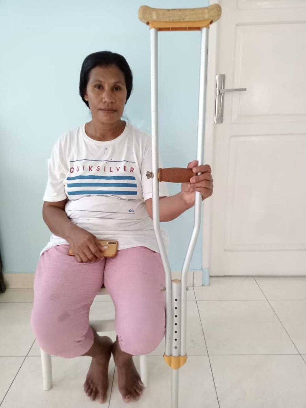 Yuliana Rafu (43) sedang menjalani perawatan di RSUD Kudungga, Kalimantan Timur, Desember 2021. Ia diduga mengalami malapraktik di rumah sakit itu. Kaki kiri yang patah, tetapi dokter malah membedah dan memasang pen di kaki kanannya.