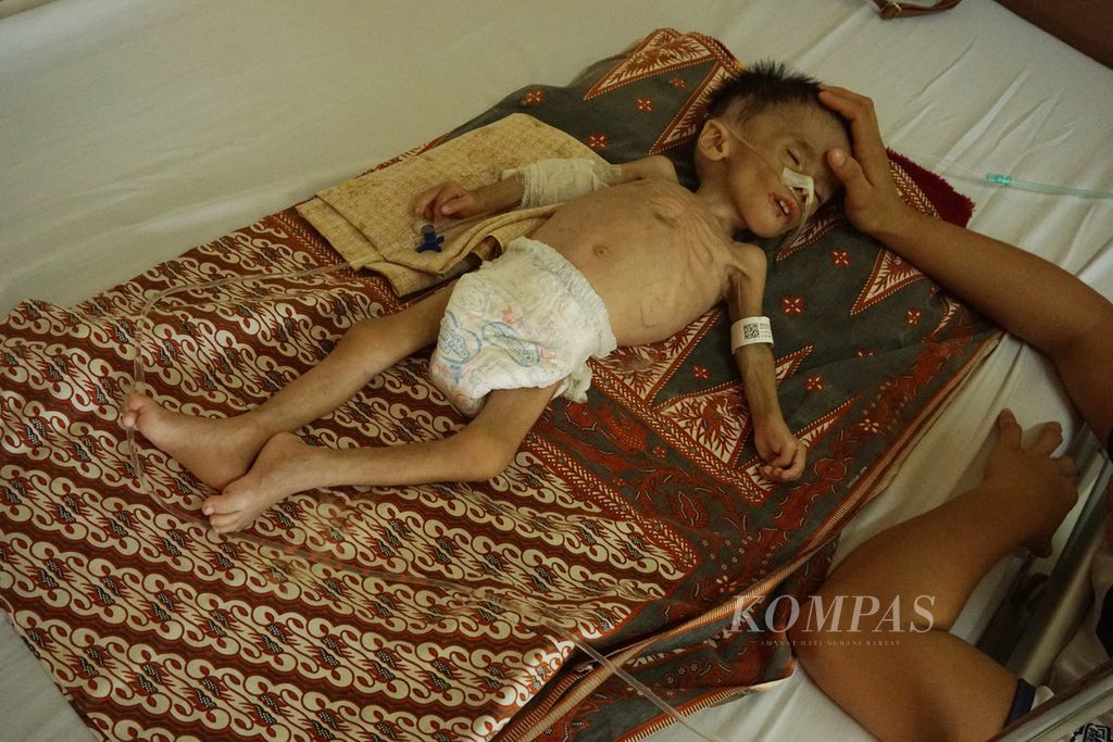 Seorang anak dari Kota Subulussalam, Provinsi Aceh, yang mengalami malanutrisi sedang menjalani perawatan di Rumah Sakit Umum Daerah Zainal Abidin, Banda Aceh, 3 Oktober 2019. Pemprov Aceh memiliki program Jaminan Kesehatan Aceh (JKA) untuk menanggung beban pengobatan warga miskin.