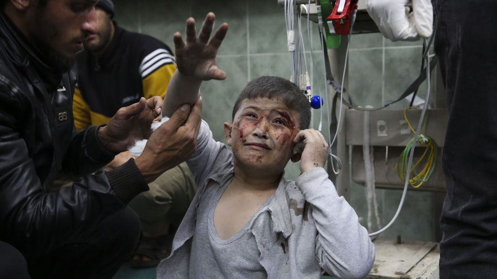 Seorang anak yang terluka dirawat di sebuah rumah sakit di Rafah, Gaza, Minggu (24/3/2024).