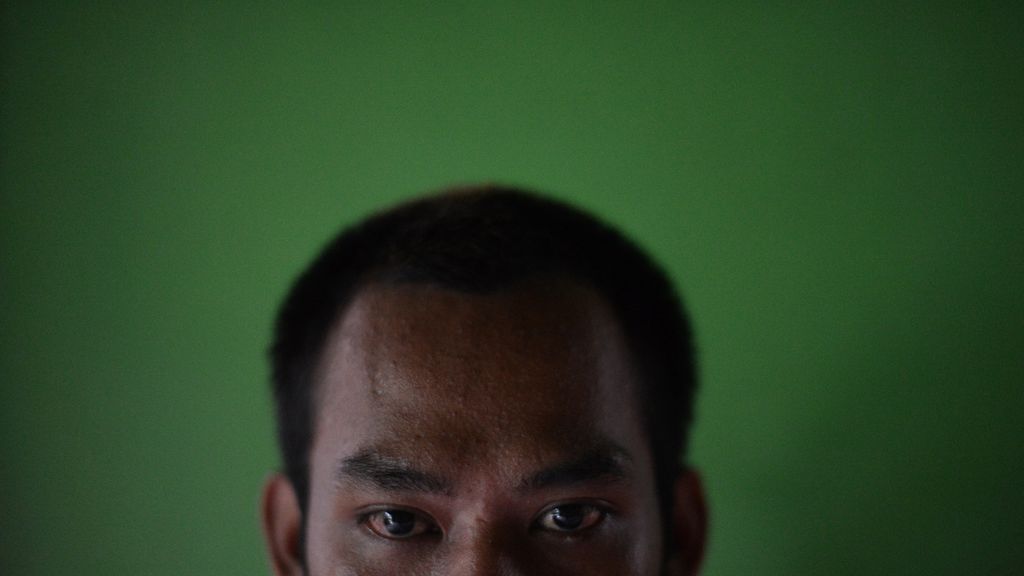 Edi Sulistia (28) duduk di  rumahnya di Desa Sinduadi, Mlati, Sleman, DI Yogyakarta, Rabu (10/2). Pria tersebut kehilangan penglihatannya akibat meminum minuman keras oplosan. 