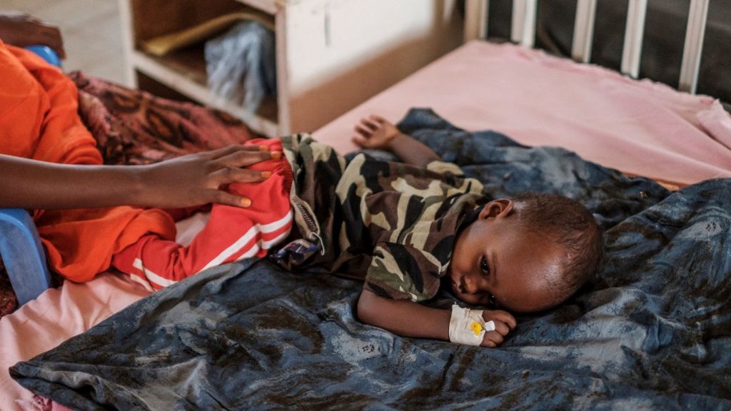 Anak kecil tergeletak di tempat tidur di unit gizi Rumah Sakit Umum Gode di Gode, Etiopia, 5 April 2022. Di wilayah itu, sebagian anak mengalami kekurangan gizi parah. 