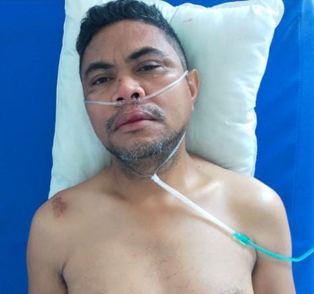 Fabi Latuan, wartawan media <i>online</i> yang dianiaya sekelompok orang yang tidak dikenal, Selasa (26/4/2022). Korban mengalami luka robek di hidung setelah ditinju.