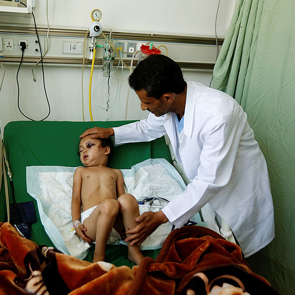 Dokter  memeriksa Buthaina Muhammad Mansour, bocah perempuan berusia 5 tahun, di rumah sakit di Sana\'a, Yaman, Sabtu (26/8). Buthaina selamat saat serangan udara koalisi pimpinan Arab Saudi menewaskan delapan anggota keluarganya.