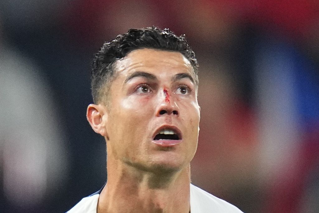 Cristiano Ronaldo, penyerang timnas Portugal, tampil dengan hidung yang berdarah saat menghadapi Ceko pada laga Liga Nasional Eropa di Stadion Sinobo, Praha, Ceko, Sabtu (24/9/2022).