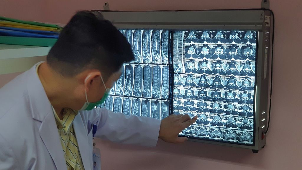 Ilustrasi-Dokter spesialis ortopedi dari Rumah Sakit Umum Pusat Fatmawati Jakarta menunjukkan lembaran film hasil rontgen dari pasien skoliosis, Jumat (10/3/2023).