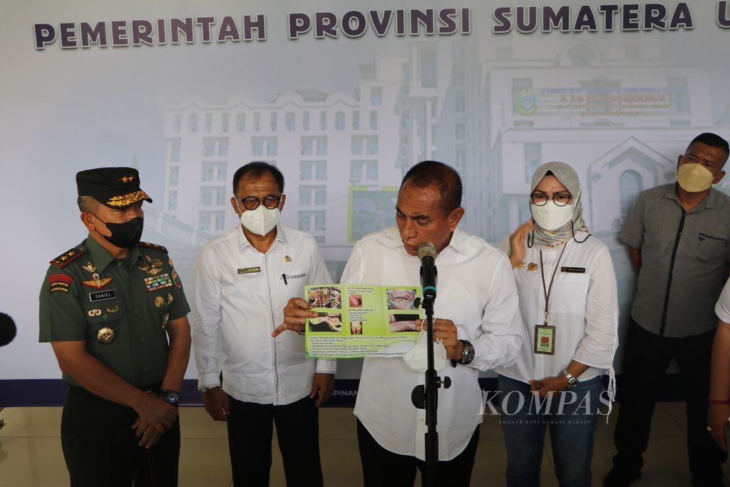Gubernur Sumatera Utara Edy Rahmayadi (tengah) didampingi Kepala Dinas Ketahanan Pangan dan Peternakan Azhar Harahap menunjukkan brosur tentang kewaspadaan dalam menghadapi penyakit mulut dan kuku, di Medan, Jumat (13/5/2022).