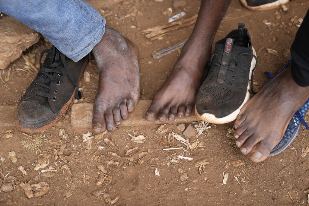 Sejumlah pedagang kaki lima melepaskan sepatu mereka untuk menunjukkan jari-jari kaki mereka di jalanan Kota Harare, Zimbabwe, Kamis (9/6/2022). 