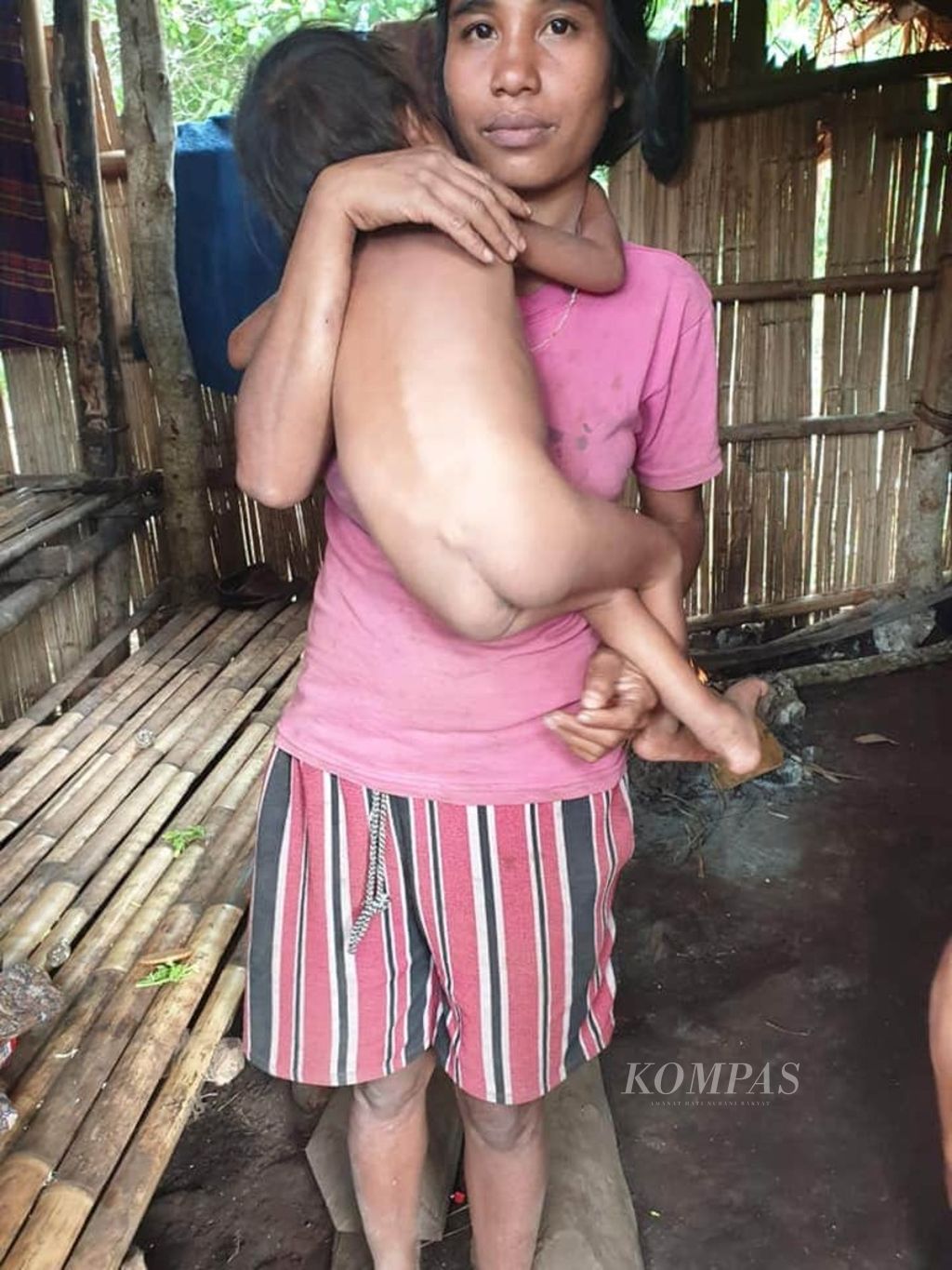Seorang ibu muda di Sumba Barat Daya menggendong anak pertamanya yang sedang menderita <i>stunting</i>. Pernikahan usia muda menjadi salah satu masalah <i>stunting</i> dan gizi buruk di Nusa Tenggara Timur. 