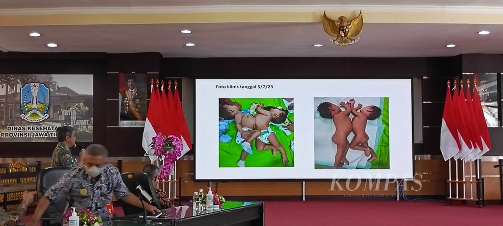 Tim dokter Rumah Sakit Saiful Anwar, Malang, memberikan keterangan pers terkait rencana operasi pemisahan kembar siam Aliyah dan Aisyah (11 bulan), Kamis (10/8/2023).