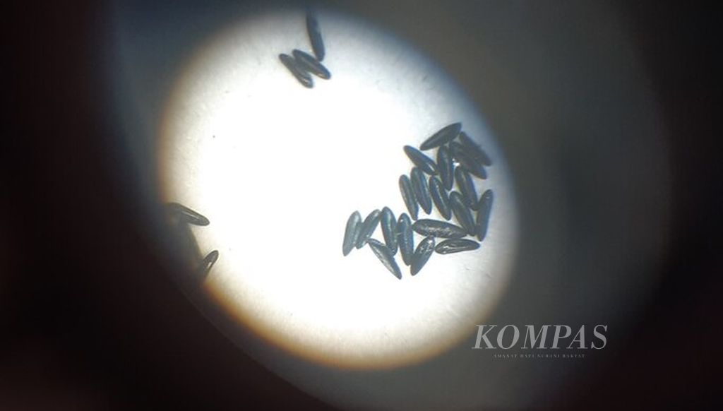 Tampilan sampel bakteri dilihat dengan menggunakan mikroskop saat acara peluncuran kampanye metode Wolbachia dan pelatihan kader juru pemantau jentik di Kota Denpasar di kompleks Graha Nawasena Rumah Harapan, Kota Denpasar, Selasa (6/6/2023).