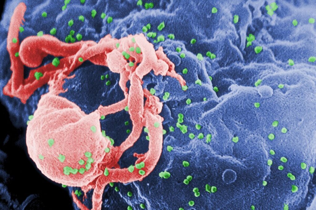 Citra yang diambil dengan mikroskop elektron menunjukkan <i>human immunodeficiency virus </i>atau HIV bermunculan sebagai bulatan-bulatan kecil (diwarnai hijau) pada permukaan limfosit. Perbanyakan HIV itu terjadi setelah virus menyerang sel sasaran.