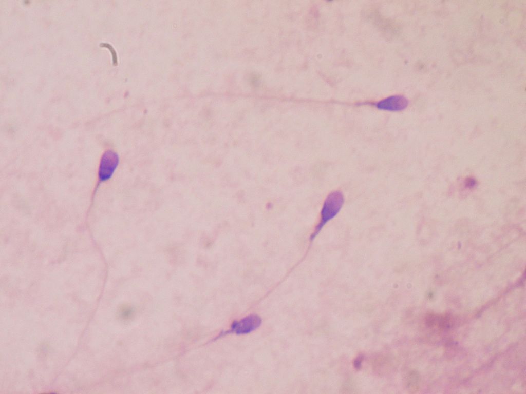 Sel sperma dalam cairan mani laki-laki di laboratorium.