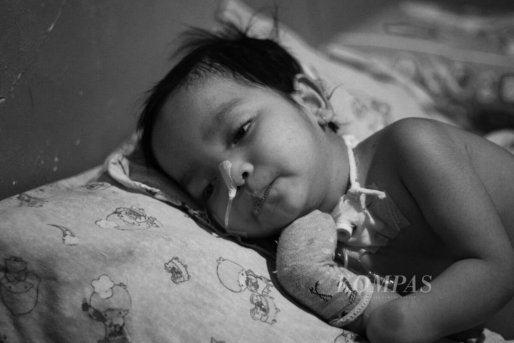 Nasifa (3) terbaring saat ibunya, Eva Nurmala (35), bersiap untuk mengganti perban lubang trakeostomi di leher anak itu, Rabu (14/6/2023). 