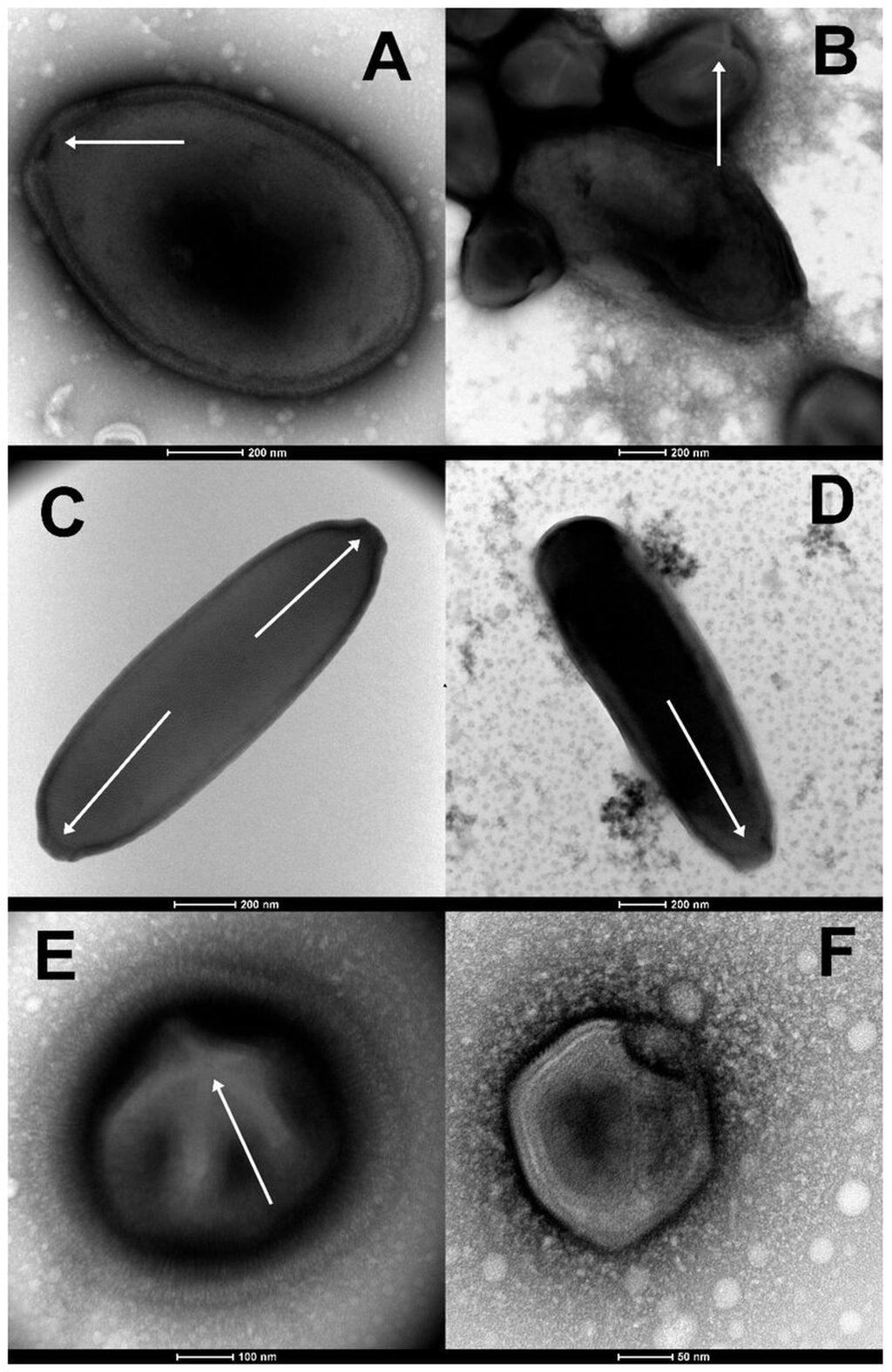 Fitur morfologi virus yang diisolasi dari lapisan tanah beku di Siberia (pewarnaan negatif, TEM). ( A ) Partikel ovoid besar (panjang 1.000 nm) dari Pandoravirus yedoma (strain Y2). (B) Campuran partikel oblate Pandoravirus mammoth (strain Yana14) dan megavirus mammoth (strain Yana14). (C) Partikel Cedratvirus lena yang memanjang (strain DY0) (panjangnya 1.500 nm) menunjukkan dua struktur seperti gabus apeks (panah putih). (D) Partikel memanjang dari mammoth Pithovirus (panjang 1.800 nm) menunjukkan struktur seperti gabus apeks tunggal (panah putih). (E) Partikel ikosahedral berbulu besar (berdiameter 770 nm) dari Megavirus mammoth (strain Yana14), menunjukkan karakteristik <i>stargate</i> (mata panah putih) dari subfamili Megavirinae. (F) Partikel icosahedral yang lebih kecil (berdiameter 200 nm) dari Pacmanvirus lupus (strain Tums2) tipikal dari asfarvirus/pacmanvirus. Kredit: Jurnal Viruses (2023).