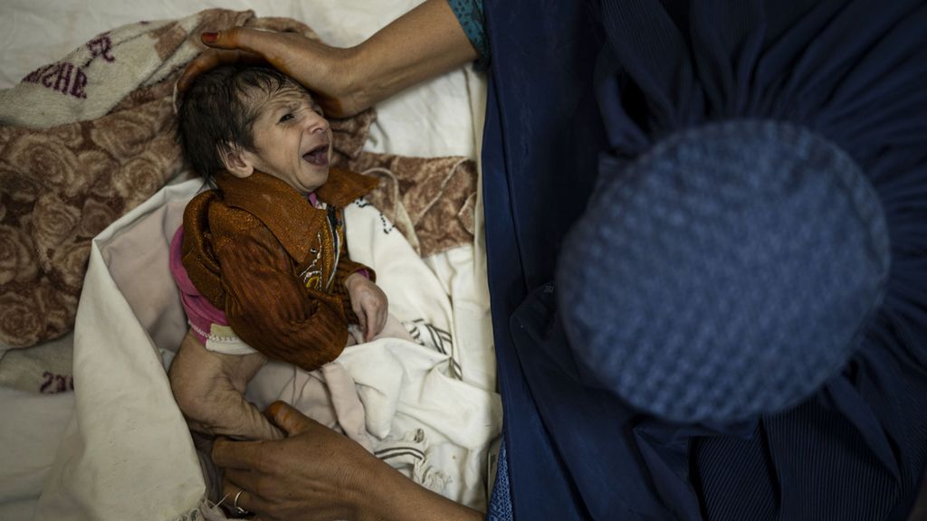 Bayi berusia dua bulan diperiksa di Rumah Sakit Anak Indira Gandhi, Kabul, Afghanistan, pada Oktober 2021. Hampir seluruh rakyat Afghanistan terancam kelaparan akibat perekonomian yang memburuk gara-gara perang dan sanksi internasional.