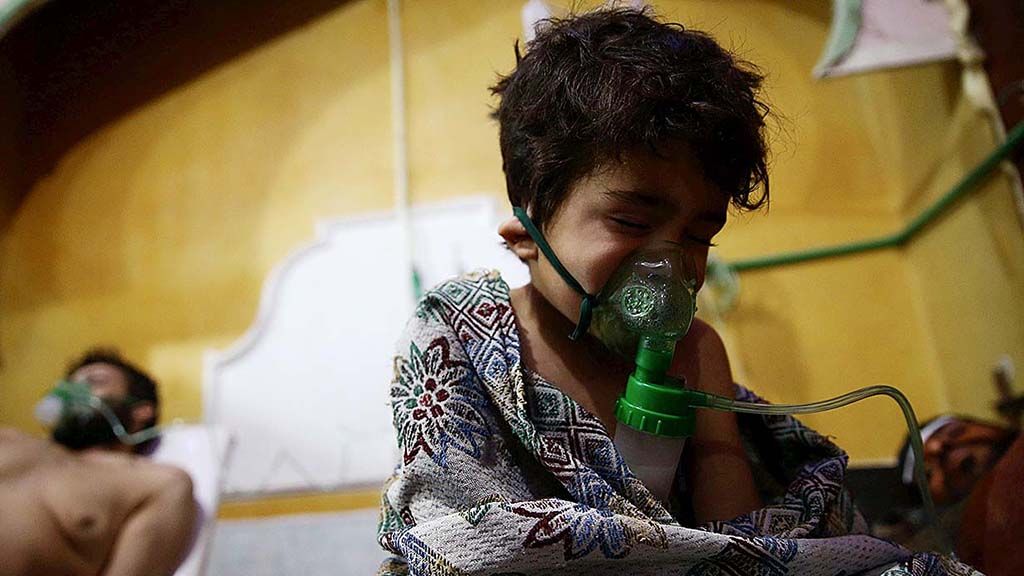Seorang anak dan seorang pria terlihat sedang menjalani perawatan di rumah sakit di kota Douma, Ghouta timur,  wilayah pinggiran ibu kota Damaskus, Suriah, Minggu (25/2). 