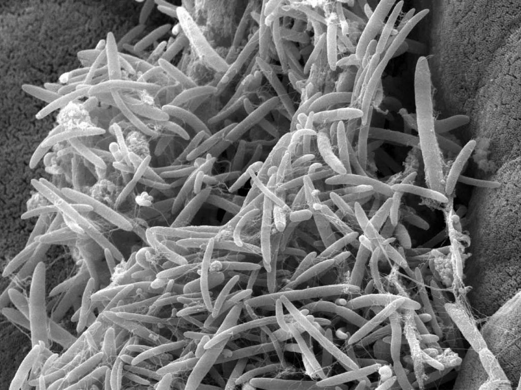 <i>Strain</i> mikrobioma usus yang terbukti mampu menghambat perkembangan penyakit ALS. Sumber: Weizmann Institute of Science