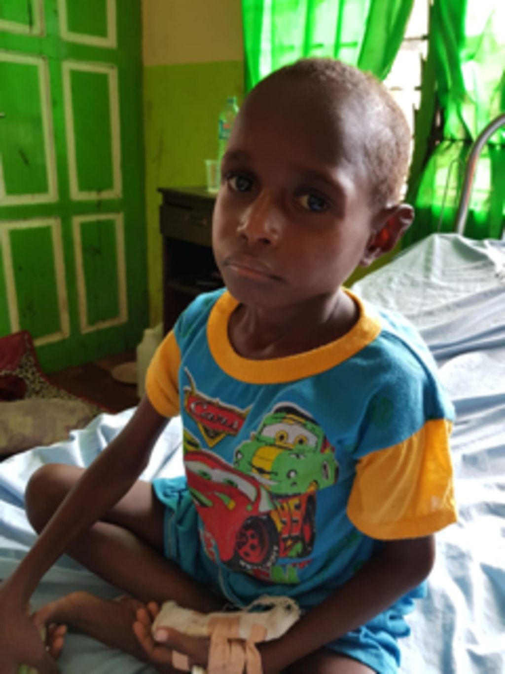 Seorang anak yang menderita gizi buruk disertai pneumonia sedang menjalani perawatan di Rumah Sakit Umum Daerah (RSUD) Agats di Kabupaten Asmat, Papua, Rabu (31/10/2018).