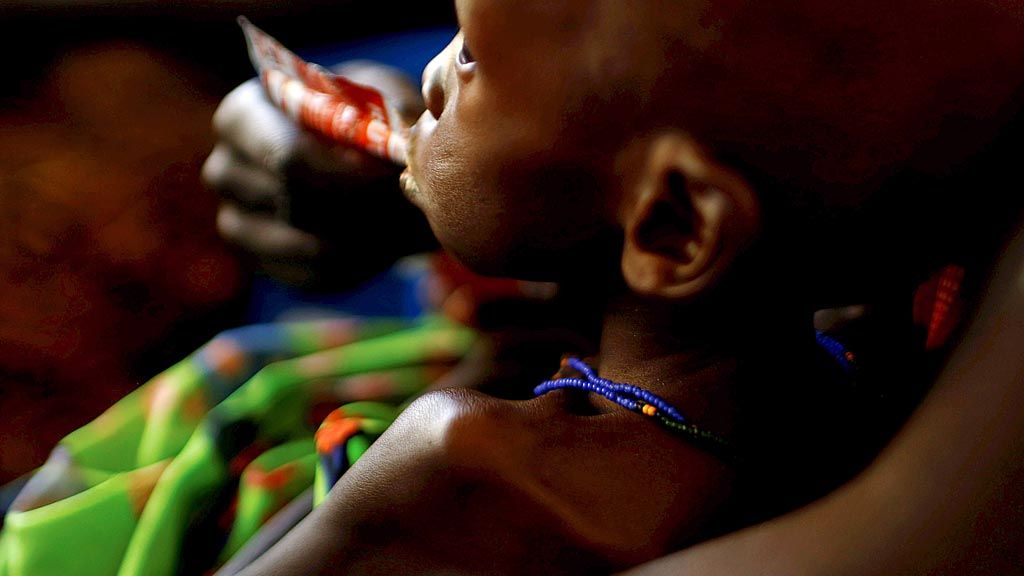 Seorang ibu  menyuapi anaknya dengan makanan khusus untuk mengatasi kekurangan nutrisi akut di rumah sakit yang didukung Badan Perserikatan Bangsa-Bangsa untuk Anak-anak (Unicef), di Juba, ibu kota Sudan Selatan, 25 Januari lalu. 