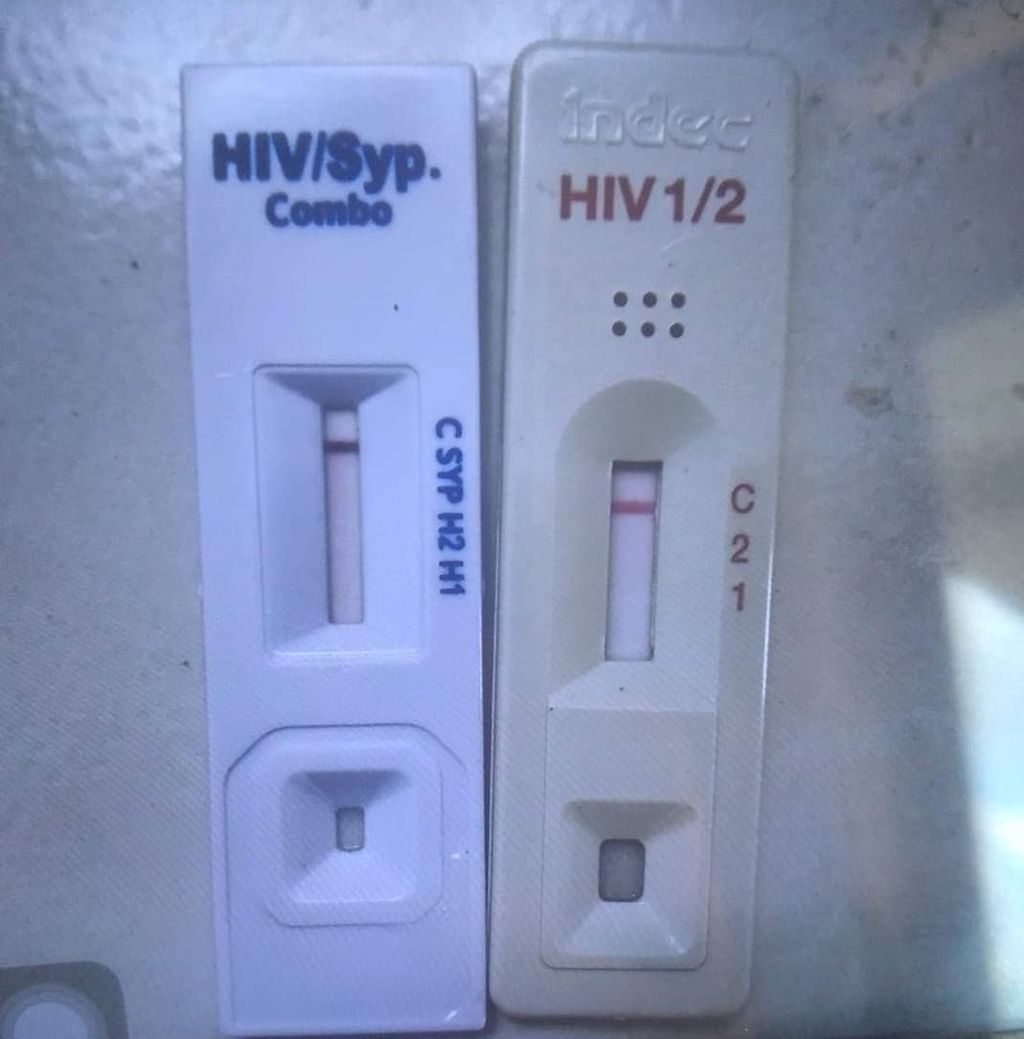 Alat tes HIV ini membantu penemuan kasus. Semakin banyak kasus ditemukan, semakin cepat ditangani dengan pemberian antiretroviral. Kasus pun sulit masuk fase AIDS.