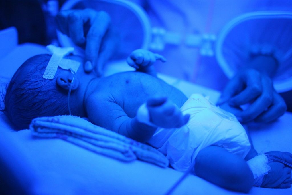 Bayi lahir prematur yang dirawat di unit perawatan bayi baru lahir Rumah Sakit Cipto Mangunkusumo, Jakarta, tengah menjalani terapi sinar.