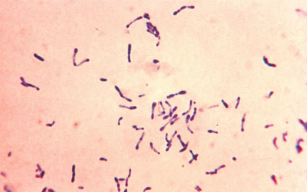 Bakteri <i>Corynebacterium diphtheriae</i> yang menyebabkan penyakit difteri.