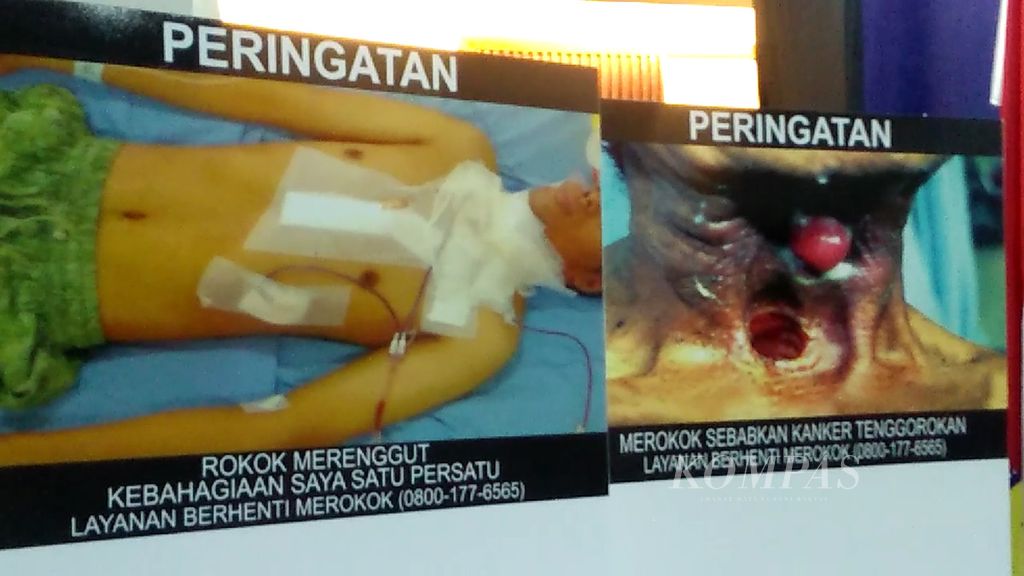 Dua gambar peringatan kesehatan bergambar dalam kemasan rokok diperlihatkan saat acara puncak Hari Tanpa Tembakau Sedunia di Jakarta, Kamis (31/5/2018). 
