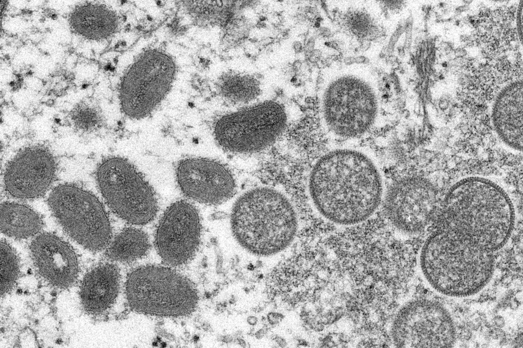 Gambar mikroskop elektron tahun 2003 oleh Pusat Pengendalian dan Pencegahan Penyakit AS menunjukkan virus cacar monyet yang matang, berbentuk oval (kiri) dan virus yang belum matang berbentuk bola (kanan) diperoleh dari sampel kulit manusia yang terkait dengan wabah anjing padang rumput tahun 2003.