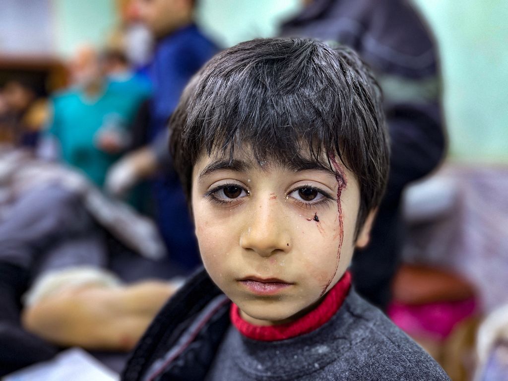 Seorang anak yang menjadi korban gempa tengah menanti perawatan luka yang dideritanya di Rumah Sakit Bab al Hawa di Idlib, sebuah provinsi yang berbatasan dengan Turki, Senin (6/2/2023). 