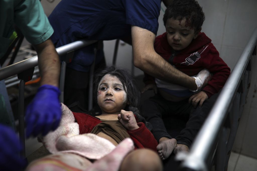 Anak-anak Gaza yang cedera dirawat di pusat penampungan pengungsi di Khan Younis, Jalur Gaza, Selasa (21/11/2023). Pada Rabu, Qatar mengumumkan Israel-Hamas sepakat melakukan jeda pertempuran selama empat hari. 
