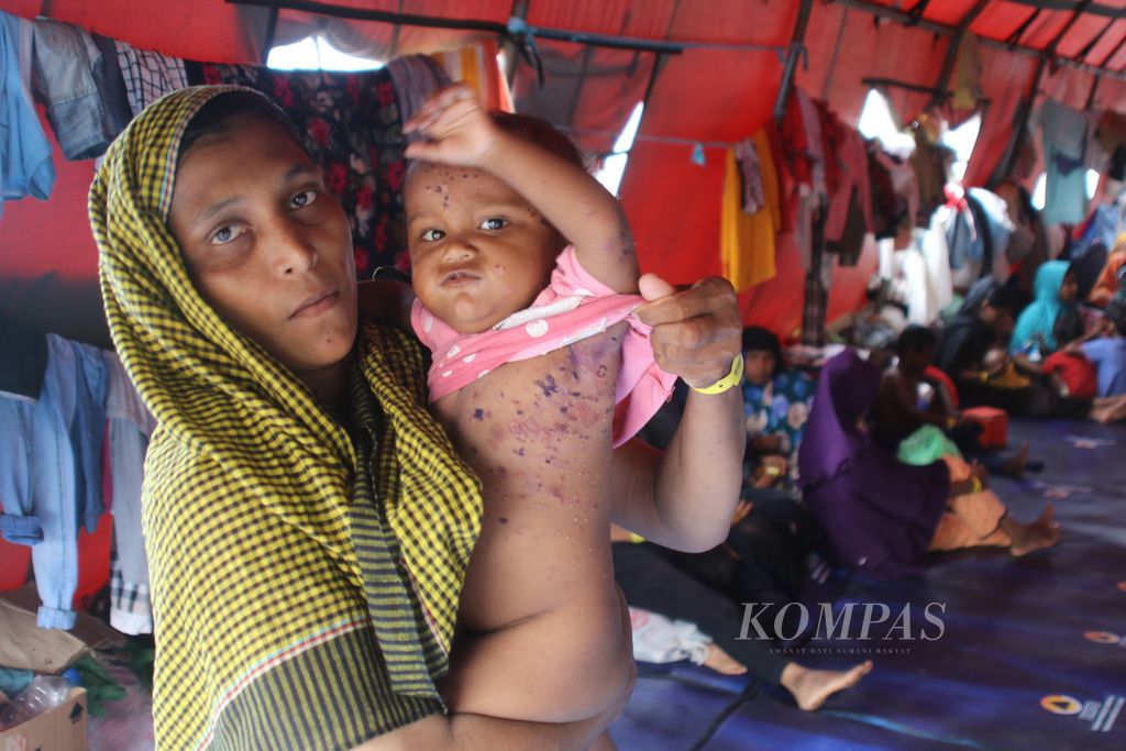Ethnic Rohingya refugees show their child affected by a skin disease after nearly three weeks in an emergency displacement camp in Karang Gading Village, Labuhan Deli District, Deli Serdang Regency, North Sumatra, on Wednesday (17/1/2024).
