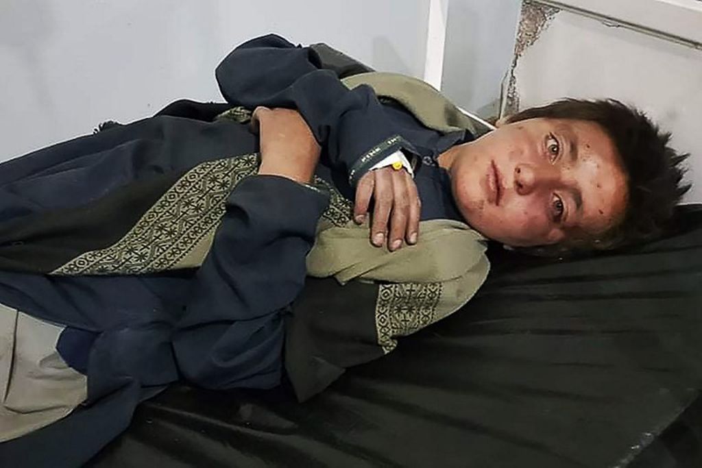 Seorang anak laki-laki yang terluka dirawat di sebuah rumah sakit setelah serangan udara Pakistan, di Khost, Sabtu (16/4/2022).  Sedikitnya lima anak dan seorang wanita tewas dalam serangan ketika pasukan militer Pakistan menembakkan roket di sepanjang perbatasan dalam serangan sebelum fajar. Demikian kata seorang pejabat dan seorang warga. 