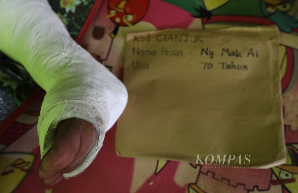 Foto rontgen rekam medis diletakkan di dekat kaki kanan Mak Aik (70) yang digips di tenda pengungsian Desa Cirumput, Kecamatan Cugenang, Kabupaten Cianjur, Jawa Barat, Kamis (1/12/2022). 
