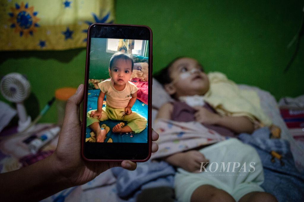 Foto Nasifa (3) ketika masih sehat dengan kondisi anak balita itu saat ini di rumahnya di Kota Batam, Kepulauan Riau, Senin (3/7/2023). 
