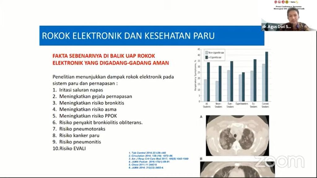 Ketua Umum Perhimpunan Dokter Paru Indonesia (PDPI) Agus Dwi Susanto menjelaskan bahaya rokok elektrik pada konferensi pers daring, Jumat (10/9/2021). Rokok elektrik memiliki potensi bahaya yang sama dengan rokok konvensional.