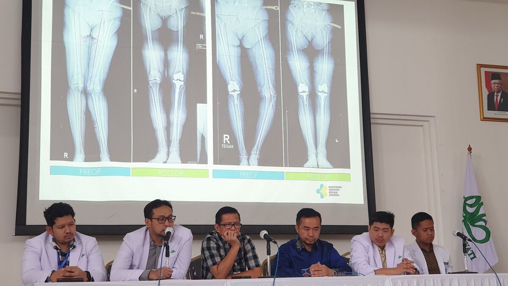 Direktur Utama Rumah Sakit Umum Pusat Fatmawati, Jakarta, Andi Saguni (ketiga dari kanan) bersama tim dokter spesialis ortopedi menjelaskan pelayanan unggulan ortopedi dan traumatologi yang ada di RSUP Fatmawati, Jumat (10/3/2023).