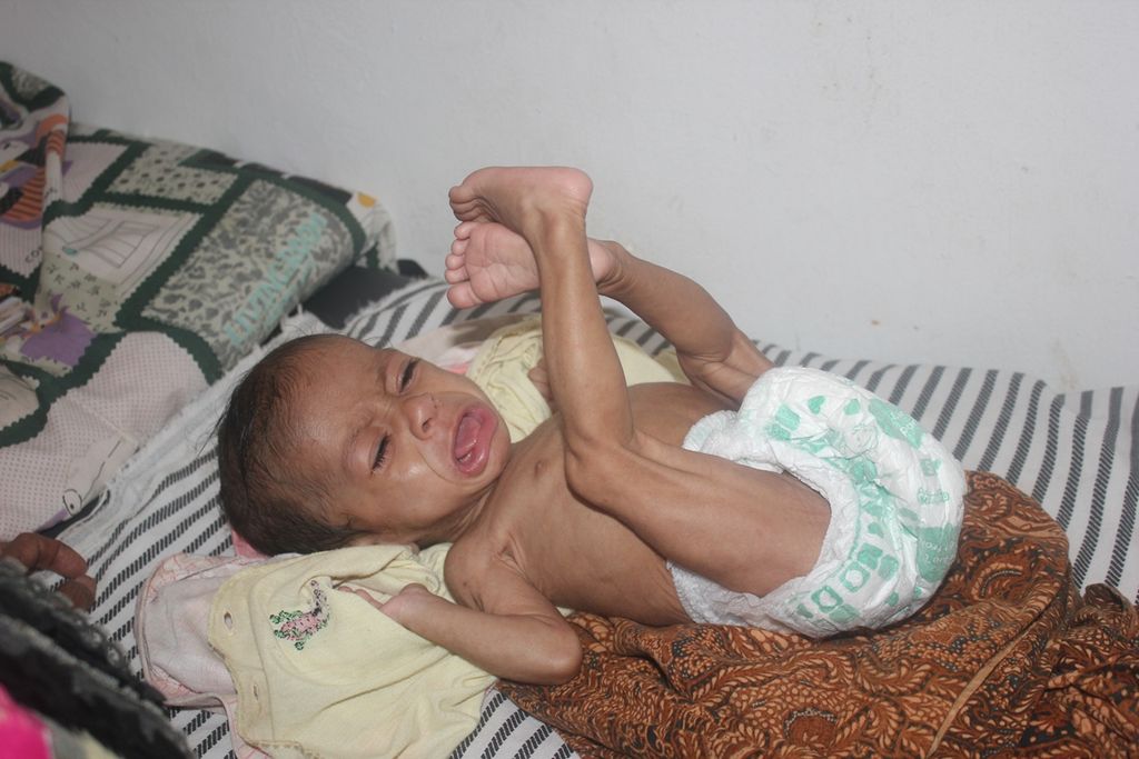 Kasus giri buruk dialami salah satu anak balita di Kefamenanu, Timor Tengah Utara. Inilah salah satu dari ribuan kasus gizi buruk yang mendera anak balita di NTT. Mereka adalah generasi masa depan yang memiliki tanggung jawab membangun NTT.