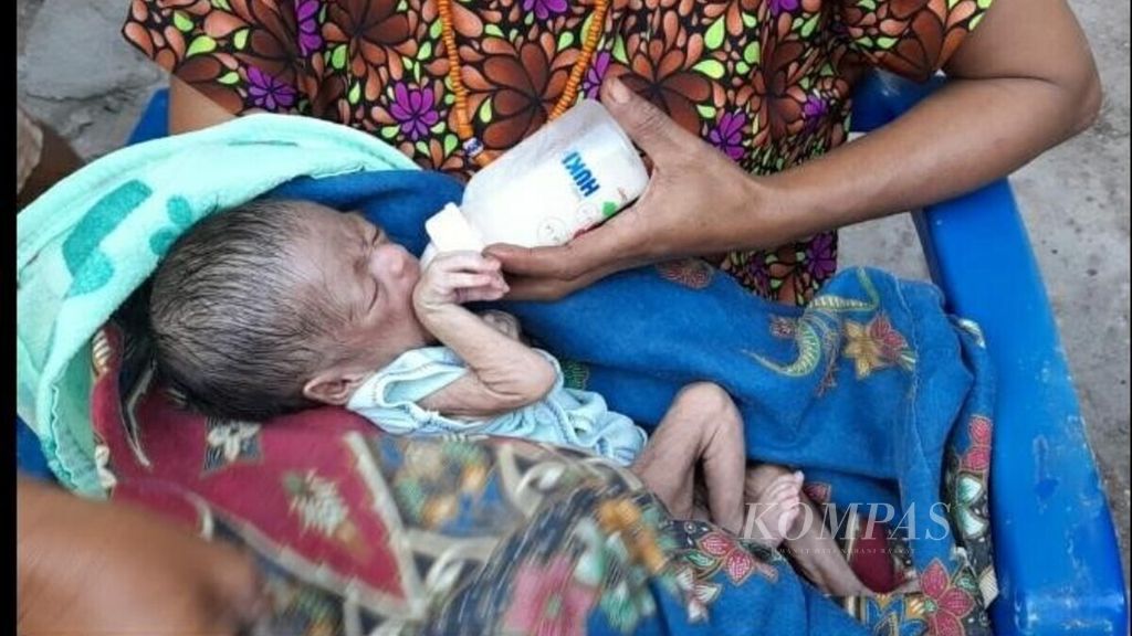Seorang anak yang mengalami gizi buruk di Kelurahan Naioni, Kota Kupang, Nusa Tenggara Timur, Jumat (30/4/2021). Kasus gizi buruk dan tengkesdi NTT menempati urutan pertama nasional. 