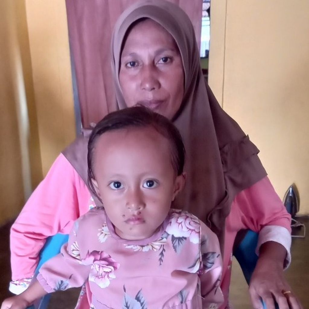 Kara Husna (4), a malnourished toddler in Wayaua Village, Bacan Timur Selatan District, South Halmahera, is on her mother's lap. Husna's weight is only 10.8 kilograms, beyond the weight range of children at her age. Husna eats more snacks than eating nutritious food.