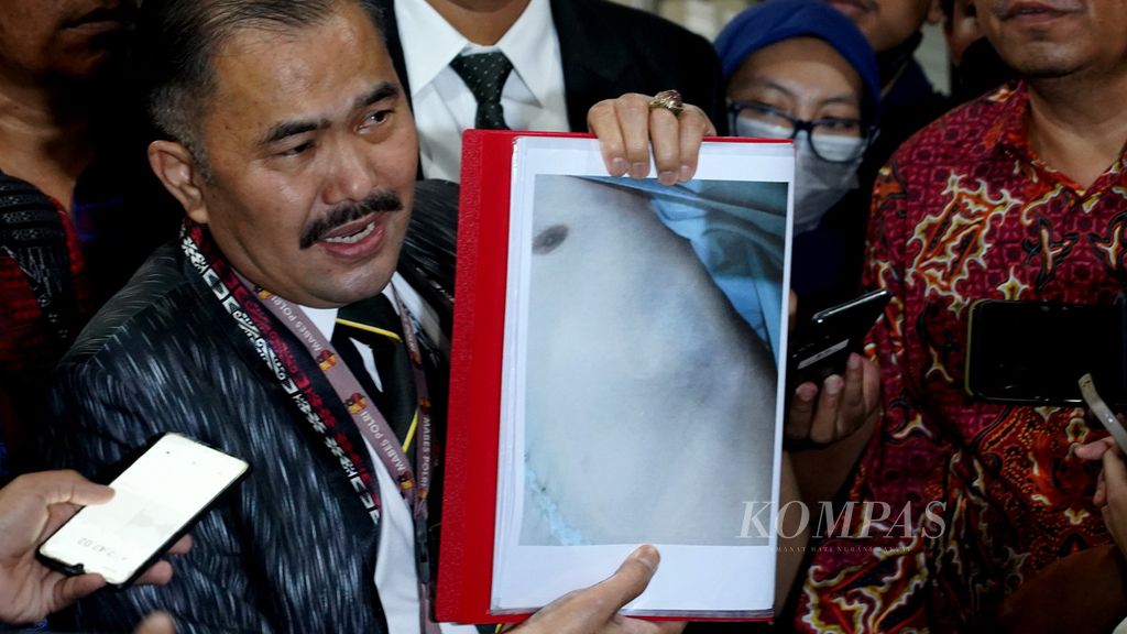 Kuasa hukum keluarga almarhum Brigadir Nofriansyah Yosua Hutabarat, Kamaruddin Simanjuntak, menunjukkan foto luka lebam pada tubuh korban yang menjadi salah satu lampiran pembuatan pelaporan resmi di Bareskrim Polri, Jakarta, Senin (18/7/2022). 