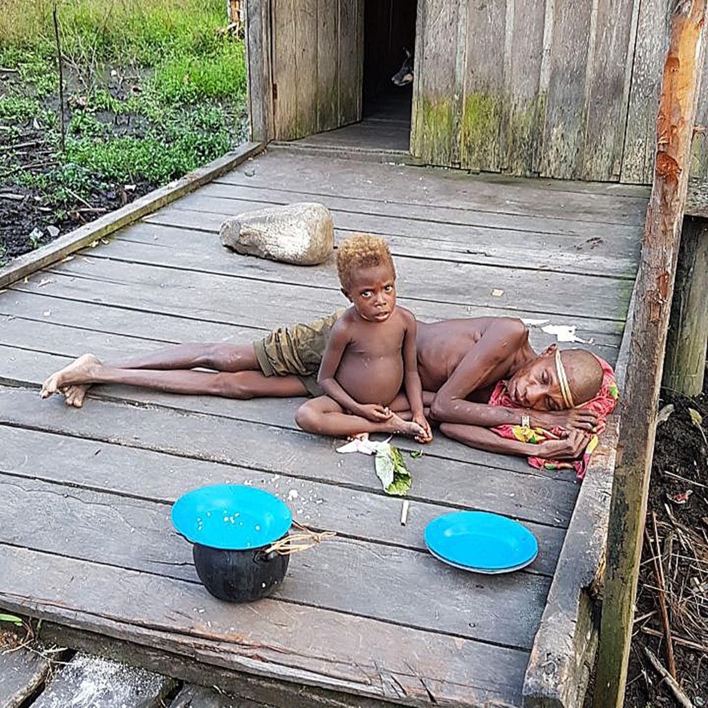 A toddler is accompanied by his mother in the courtyard of the house in Kampung Adat, Pulau Tiga District, Asmat Regency, Papua. Throughout December 2017, dozens of children under five in Asmat District, died due to malnutrition and contracted diseases due to not receiving immunization services.