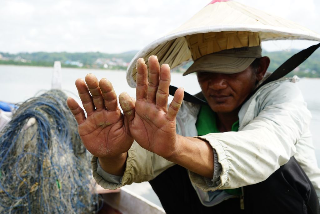Nasir (41), a small crab fisherman shows his yellowed hands after looking for catch in Kendari Bay, Friday (26/3/2021), in Kendari, Southeast Sulawesi.