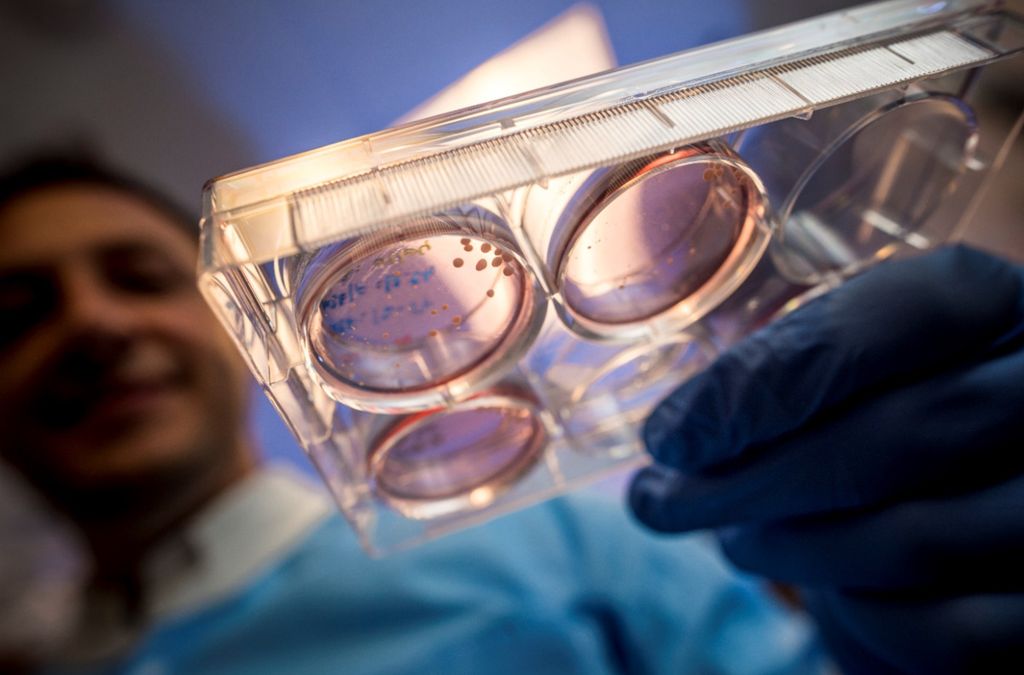 Sel punca yang ditumbuhkan menjadi organoid otak di Laboratorium Moutri, Universitas California San Diego, di La Jolla, AS, selama satu bulan hingga kemudian dikirimkan ke Stasiun Ruang Angkasa Internasional (ISS).